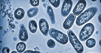 Vištų kiaušiniuose gali slypėti salmonelės