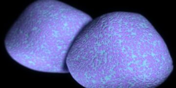 Dėl lėtinės ligos nusilpusį imunitetą atakuoja pneumokokinė infekcija