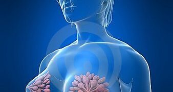 Sveika gyvensena saugant krūtų sveikatą