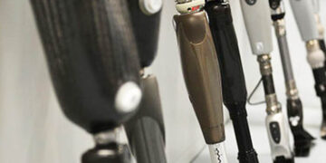 Modernūs protezai gali būti kompensuojami bet kokio amžiaus pacientams