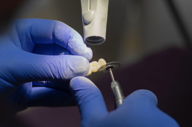 Ką valgyti atlikus dantų protezavimo procedūrą?