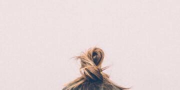 Galvos pleiskanos: atsiradimo priežastys ir kaip su jomis kovoti?