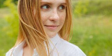 Strazdanos vasarą: kodėl jų padaugėja ir kaip prižiūrėti savo odą?